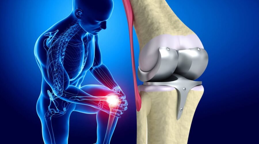 Joint Replacement